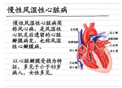 风湿性心脏病有什么症状 风湿性心脏病症状