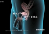男性前列腺在人体的哪个位置 前列腺指的是什么部位